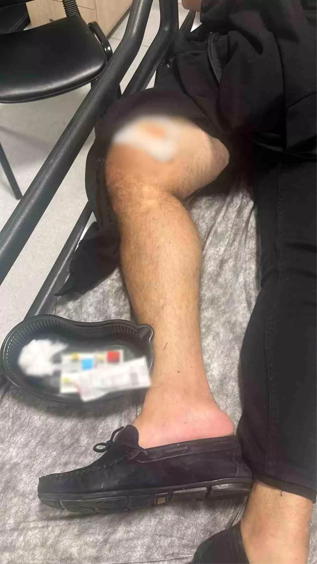 Marmaris'te Silahlı Kavga: 1 Yaralı