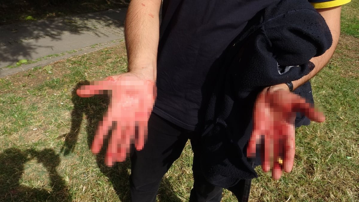 Antalya'da. eline aldığı bıçakla yoldan geçen vatandaşlara saldırdı