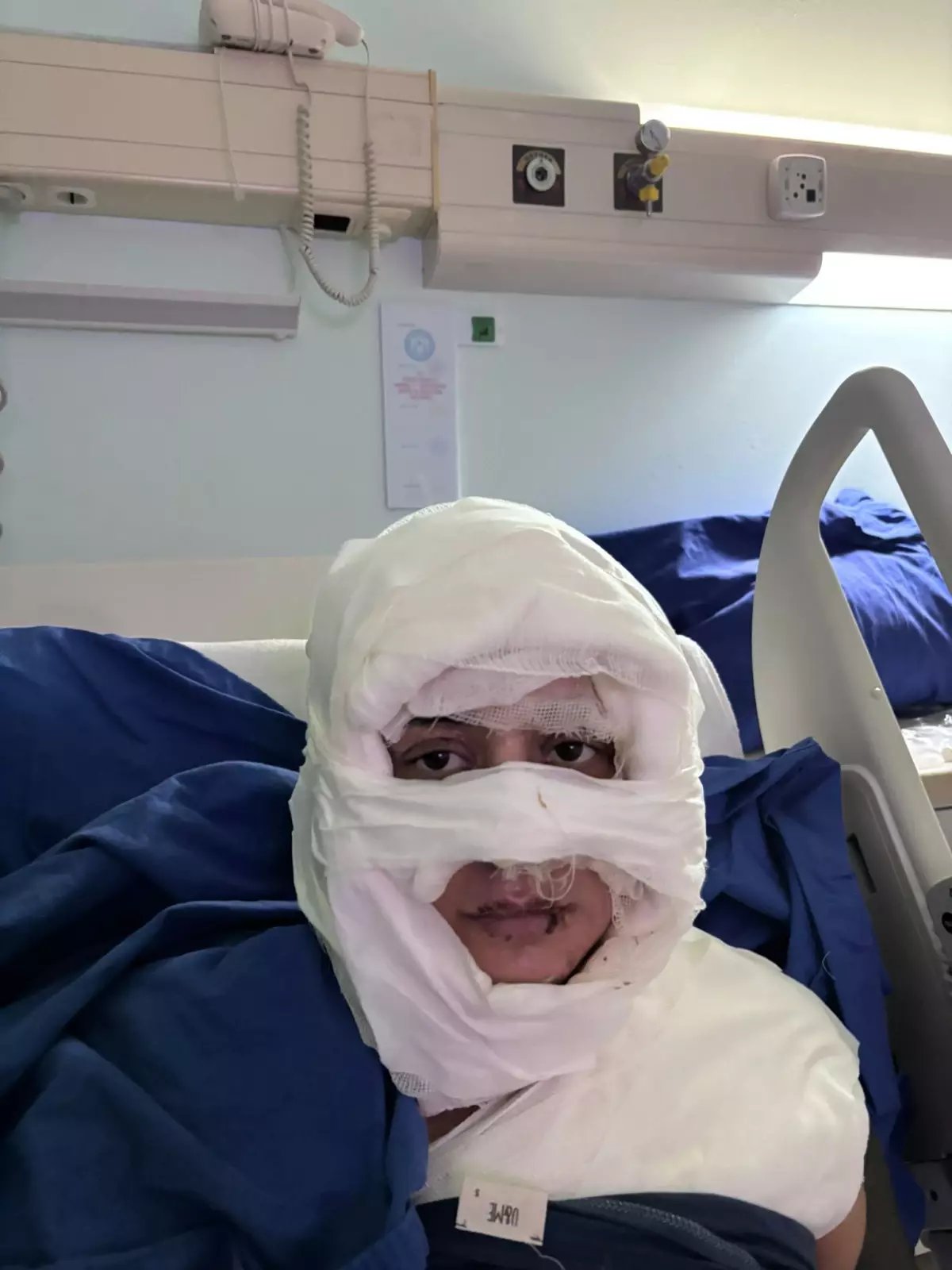 Kadıköy'de Kadına Yanan Saldırı: Şüpheli Tutuklandı