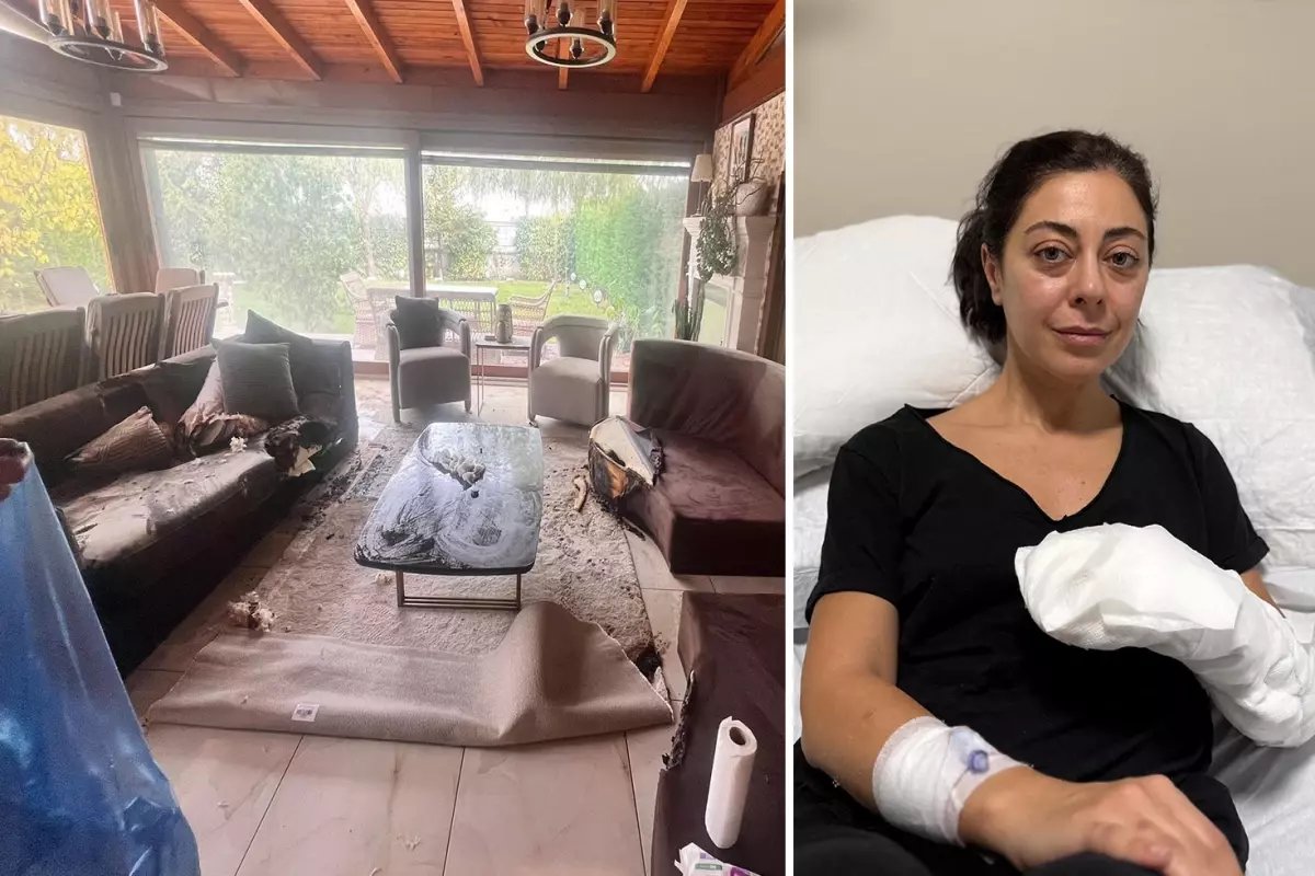 Dekoratif şömine bomba gibi patladı, vücudunun yüzde 30'u yandı