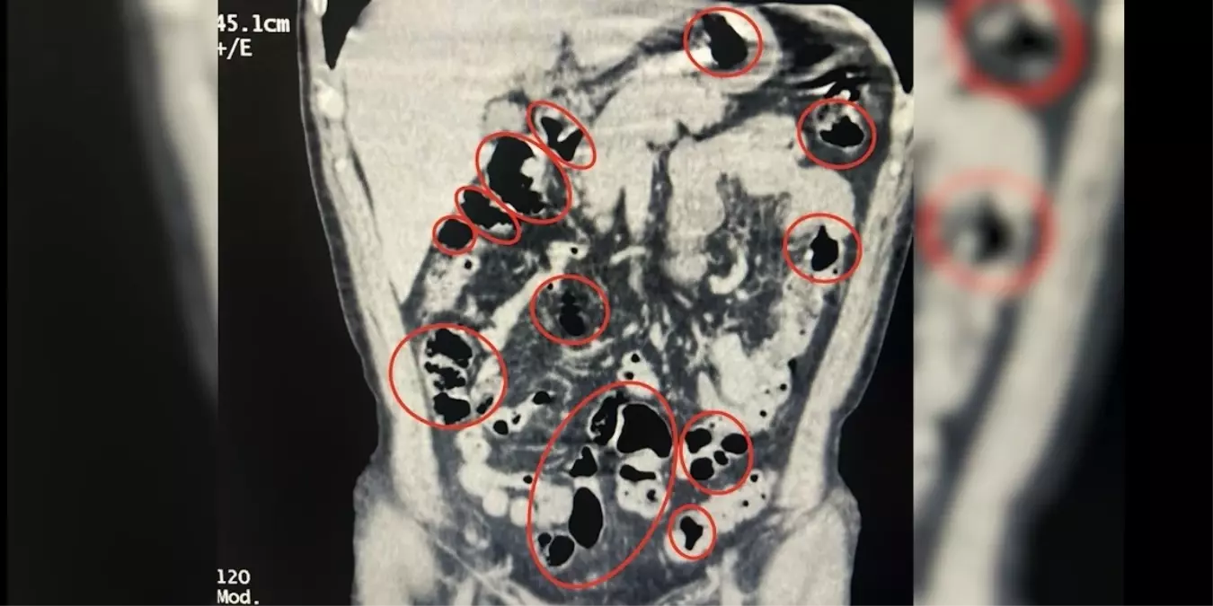 Bitlis'te Uyuşturucu Operasyonu: 4 Gözaltı