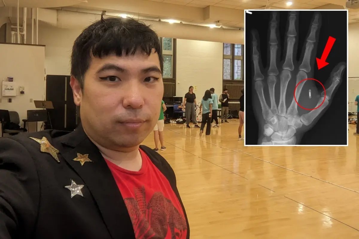 Akılalmaz hata! Eline yerleştirdiği mikroçipin şifresini unuttu