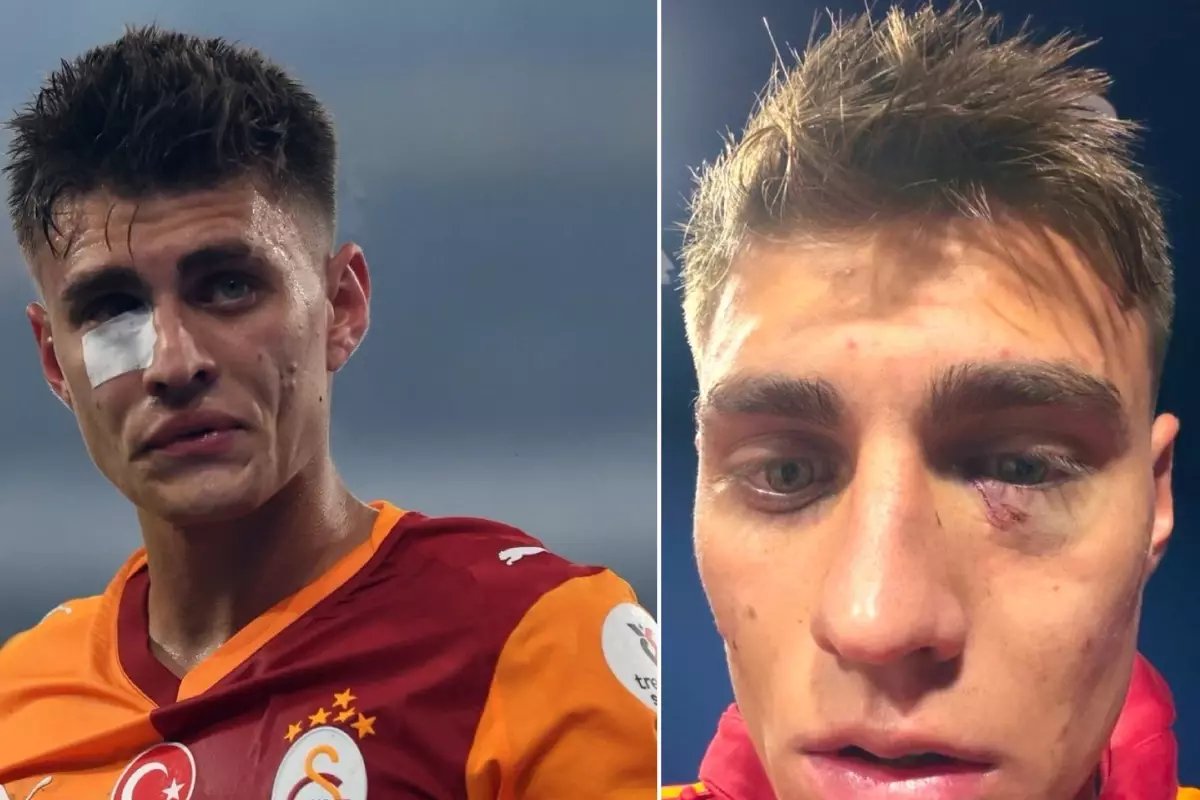 Kazımcan Karataş'a çakmak atan kişi hakkında karar çıktı