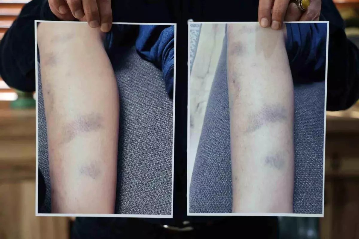 Diyarbakır'da özel okulda 8 yaşındaki çocuğun darbedildiği iddiası