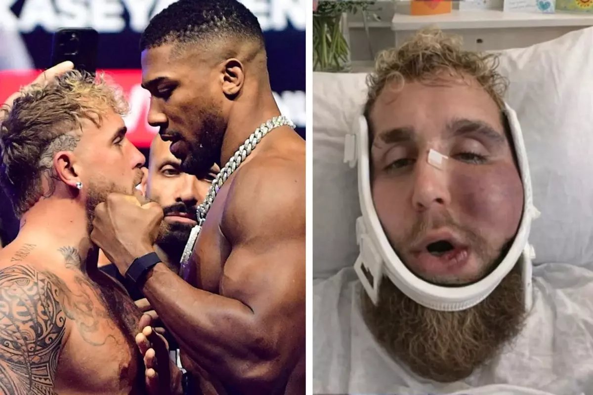 Suratı tanınmaz hale gelen Jake Paul'un ne kadar kazandığını duyunca şok olacaksınız