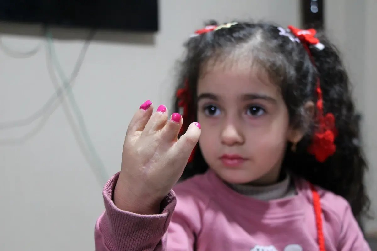 10 ameliyat geçiren yapışık parmak Elif Lina'nın ailesinden çağrı