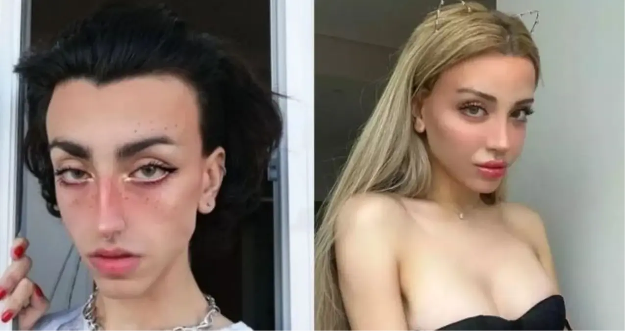 Mika Raun eski hali nasıl? Mika Raun'un eski cinsiyeti nedir, eski adı nedir?