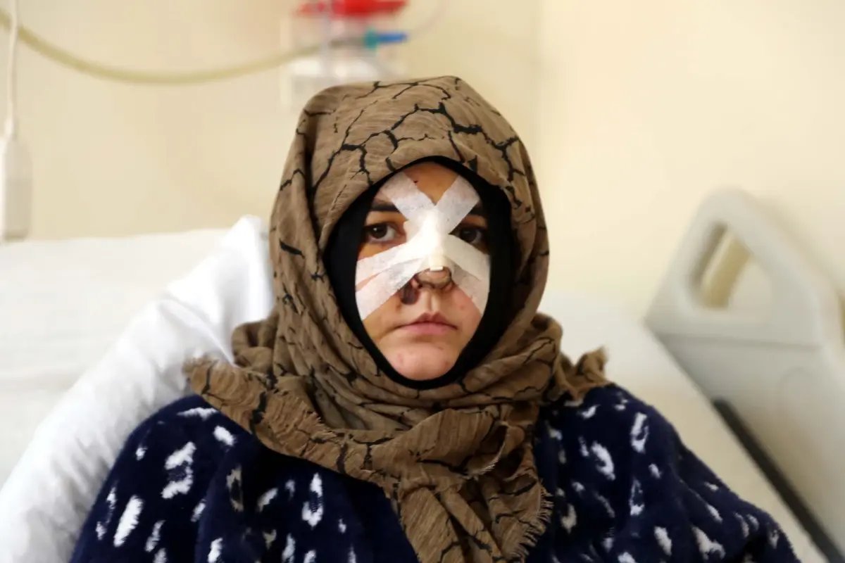 Eşinin kaldırım taşı ile dövdüğü Nazlı: Çıkarsa yarım bıraktığı işi tamamlar