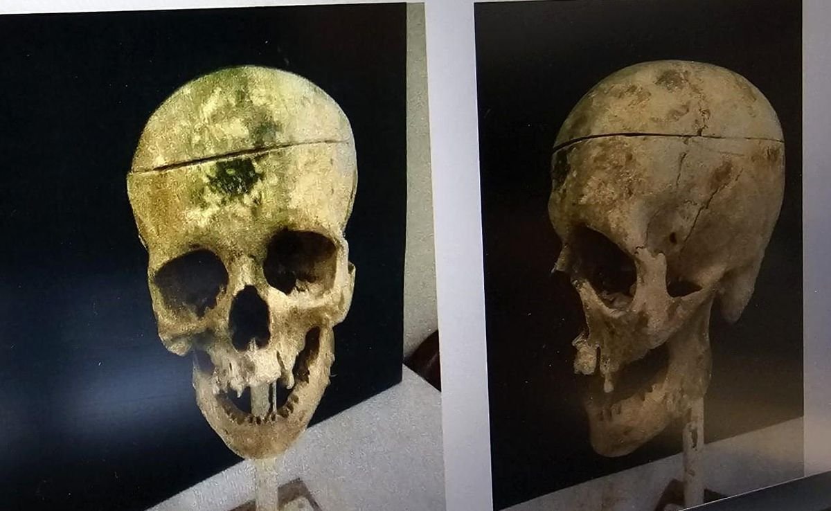 Barajdaki kemiklerle 18 yıllık cinayetin sırrı çözüldü