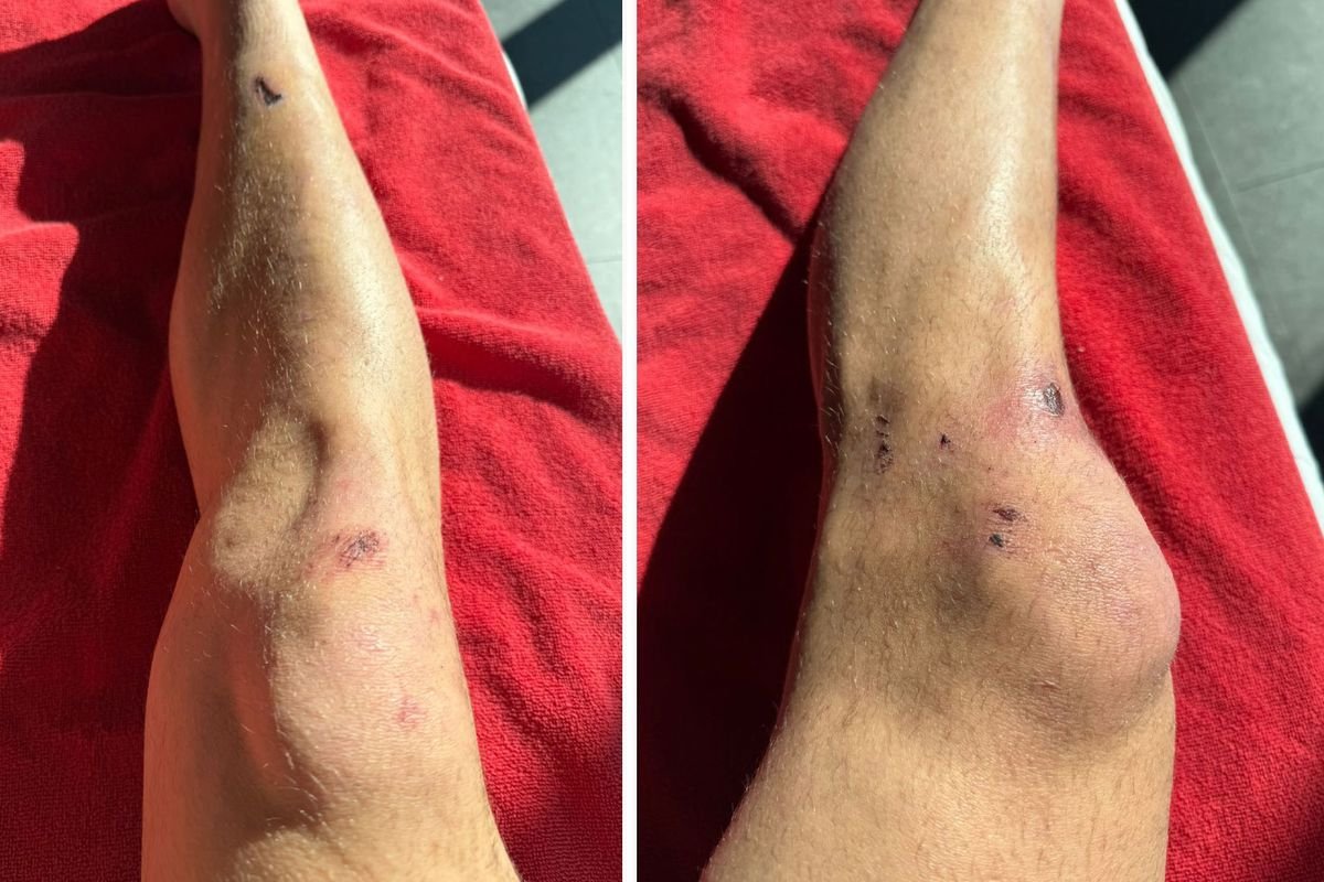 Dün gece yaşanan tarihi zaferin bedeli