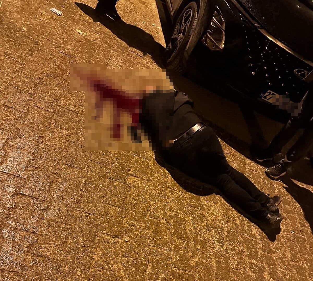 Sokakta yürürken tabanca ile başından vuruldu